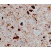 Red Quartz Countertop RK9649