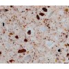 Red Quartz Countertop RK9649