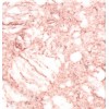 Pink Artificial Stone T2119