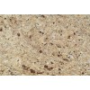 New Venetian Gold Granite Tile