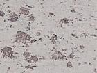 Limestone
