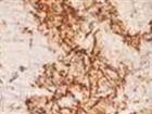 Embroidery